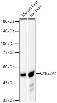 Western Blot: CYP27A1 Antibody (6L9D1) [NBP3-33416] - Western blot analysis of various lysates, using CYP27A1 Rabbit mAb at 1:3000 dilution.Secondary antibody: HRP-conjugated Goat anti-Rabbit IgG (H+L) at 1:10000 dilution.Lysates/proteins: 25ug per lane.Blocking buffer: 3% nonfat dry milk in TBST.Detection: ECL Basic Kit.Exposure time: 30s.