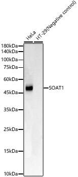 Western Blot: SOAT1 Antibody (8J8E6) [NBP3-33418] - Western blot analysis of various lysates, using SOAT1 Rabbit mAb at 1:1000 dilution.Secondary antibody: HRP-conjugated Goat anti-Rabbit IgG (H+L) at 1:10000 dilution.Lysates/proteins: 25ug per lane.Blocking buffer: 3% nonfat dry milk in TBST.Detection: ECL Basic Kit.Exposure time: 30s.