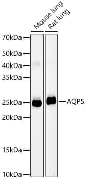 Western Blot: Aquaporin-5 Antibody (10V2Y1) [NBP3-33420] - Western blot analysis of various lysates, using Aquaporin-5 Rabbit mAb at 1:2000 dilution.Secondary antibody: HRP-conjugated Goat anti-Rabbit IgG (H+L) at 1:10000 dilution.Lysates/proteins: 25ug per lane.Blocking buffer: 3% nonfat dry milk in TBST.Detection: ECL Basic Kit.Exposure time: 180s.