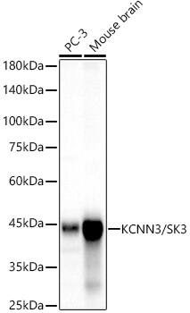 Western Blot: KCNN3 Antibody (3G7W0) [NBP3-33423] - Western blot analysis of various lysates, using KCNN3 Rabbit mAb at 1:2000 dilution.Secondary antibody: HRP-conjugated Goat anti-Rabbit IgG (H+L) at 1:10000 dilution.Lysates/proteins: 25ug per lane.Blocking buffer: 3% nonfat dry milk in TBST.Detection: ECL Basic Kit.Exposure time: 30s.