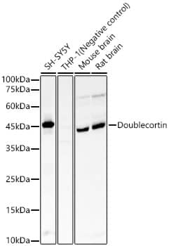 Western Blot: Doublecortin Antibody (5F9B2) [NBP3-33429] - Western blot analysis of various lysates, using Doublecortin Rabbit mAb at 1:7000 dilution.Secondary antibody: HRP-conjugated Goat anti-Rabbit IgG (H+L) at 1:10000 dilution.Lysates/proteins: 25ug per lane.Blocking buffer: 3% nonfat dry milk in TBST.Detection: ECL Basic Kit.Exposure time: 180s.