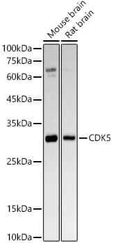 Western Blot: Cdk5 Antibody (6O8F8) [NBP3-33430] - Western blot analysis of various lysates, using [KO Validated] Cdk5 Rabbit mAb at1:2000 dilution.Secondary antibody: HRP-conjugated Goat anti-Rabbit IgG (H+L) at 1:10000 dilution.Lysates/proteins: 25ug per lane.Blocking buffer: 3% nonfat dry milk in TBST.Detection: ECL Basic Kit.Exposure time: 180s.