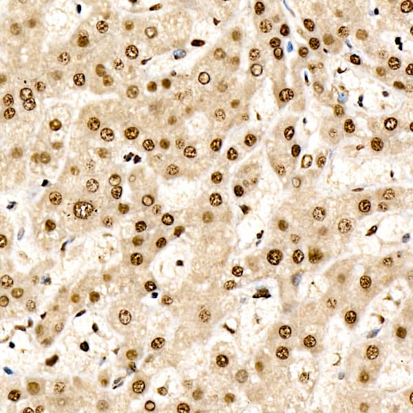 Western Blot: CHD4 Antibody (0M3R5) [NBP3-33432] - Western blot analysis of lysates from HeLa cells using CHD4 Rabbit mAb at 1:20000 dilution incubated overnight at 4C.Secondary antibody: HRP-conjugated Goat anti-Rabbit IgG (H+L) at 1:10000 dilution.Lysates/proteins: 25 ug per lane.Blocking buffer: 3% nonfat dry milk in TBST.Detection: ECL Basic Kit.Exposure time: 1s.