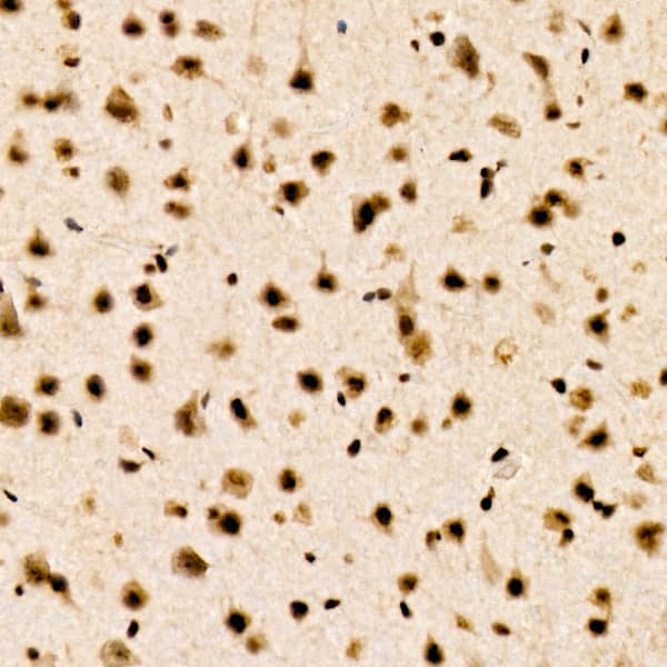 Immunohistochemistry: CHD4 Antibody (0M3R5) [NBP3-33432] - Immunohistochemistry analysis of paraffin-embedded Human spleen using CHD4 Rabbit mAb at dilution of 1:200 (40x lens). High pressure antigen retrieval performed with 0.01M Citrate Bufferr (pH 6.0) prior to IHC staining.