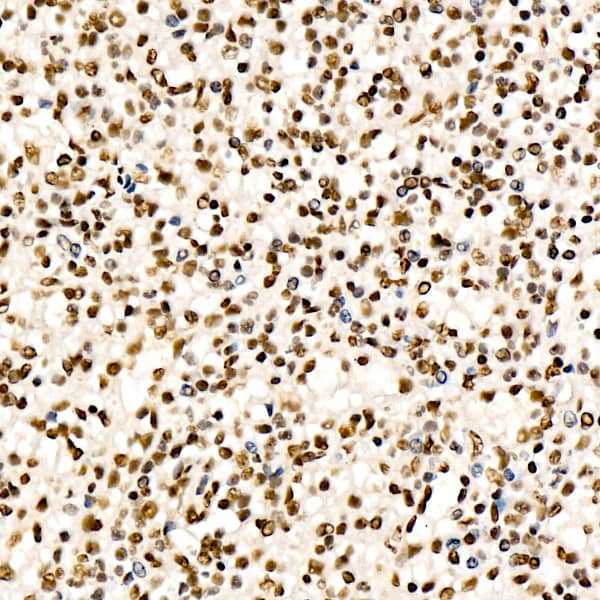 Immunohistochemistry: CHD4 Antibody (0M3R5) [NBP3-33432] - Immunohistochemistry analysis of paraffin-embedded Human liver using CHD4 Rabbit mAb at dilution of 1:200 (40x lens). High pressure antigen retrieval performed with 0.01M Citrate Bufferr (pH 6.0) prior to IHC staining.