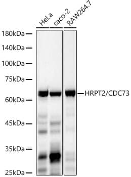 Western Blot: CDC73/HRPT2 Antibody (1B8Q1) [NBP3-33442] - Western blot analysis of various lysates, using CDC73/HRPT2 Rabbit mAb at 1:800 dilution.Secondary antibody: HRP-conjugated Goat anti-Rabbit IgG (H+L) at 1:10000 dilution.Lysates/proteins: 25ug per lane.Blocking buffer: 3% nonfat dry milk in TBST.Detection: ECL Basic Kit.Exposure time: 30s.