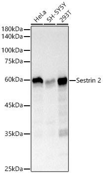 Western Blot: SESN2 Antibody (8I1W4) [NBP3-33447] - Western blot analysis of various lysates, using SESN2 Rabbit mAb at  1:2000 dilution.Secondary antibody: HRP-conjugated Goat anti-Rabbit IgG (H+L) at 1:10000 dilution.Lysates/proteins: 25ug per lane.Blocking buffer: 3% nonfat dry milk in TBST.Detection: ECL Basic Kit.Exposure time: 3s.