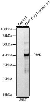 Western Blot: Pejvakin Antibody (10R1X6) [NBP3-33449] - Western blot analysis of lysates from wild type (WT) and 293T cells transfected with PJVK, using PJVK Rabbit mAb at 1:1000 dilution.Secondary antibody: HRP-conjugated Goat anti-Rabbit IgG (H+L) at 1:10000 dilution.Lysates/proteins: 25μg per lane.Blocking buffer: 3% nonfat dry milk in TBST.Detection: ECL Basic Kit.Exposure time: 45s.WB samples for antibody validation are kindly provided by Dr. Feng Shao, NIBS