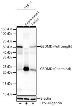 Western Blot: GSDMDC1 Antibody (8K8C6) [NBP3-33450] - Western blot analysis of lysates from THP-1 cells using GSDMD (Full Length+C terminal) Rabbit mAb at 1:2000 dilution. THP-1 cells were treated by LPS and Nigericin.Secondary antibody: HRP-conjugated Goat anti-Rabbit IgG (H+L) at 1:10000 dilution.Lysates/proteins: 25 ug per lane.Blocking buffer: 3% nonfat dry milk in TBST.Detection: ECL Basic Kit.Exposure time: 30s.WB samples for antibody validation are kindly provided by Dr. Feng Shao, NIBS