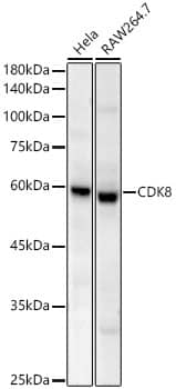 Western Blot: CDK8 Antibody (2P3P8) [NBP3-33454] - Western blot analysis of various lysates, using CDK8 Rabbit mAb at 1:2000 dilution.Secondary antibody: HRP-conjugated Goat anti-Rabbit IgG (H+L) at 1:10000 dilution.Lysates/proteins: 25ug per lane.Blocking buffer: 3% nonfat dry milk in TBST.Detection: ECL Basic Kit.Exposure time: 90s.
