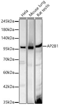 Western Blot: Beta 2 Adaptin Antibody (9W4U6) [NBP3-33456] - Western blot analysis of various lysates, using Beta 2 Adaptin Rabbit mAb at 1:1000 dilution.Secondary antibody: HRP-conjugated Goat anti-Rabbit IgG (H+L) at 1:10000 dilution.Lysates/proteins: 25ug per lane.Blocking buffer: 3% nonfat dry milk in TBST.Detection: ECL Basic Kit.Exposure time: 10s.