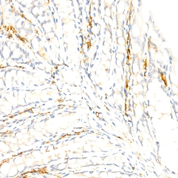 Immunohistochemistry: F4/80 Antibody (4J7L6) [NBP3-33457] - Immunohistochemistry analysis of paraffin-embedded Mouse liver using F4/80 Rabbit mAb at dilution of 1:200 (40x lens). High pressure antigen retrieval performed with 0.01M Citrate Bufferr (pH 6.0) prior to IHC staining.