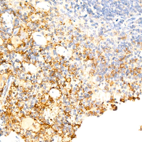 Immunohistochemistry: F4/80 Antibody (4J7L6) [NBP3-33457] - Immunohistochemistry analysis of paraffin-embedded mouse spleen using F4/80 Rabbit mAb at dilution of 1:200 (40x lens).Perform high pressure antigen retrieval with 10 mM citrate buffer pH 6.0 before commencing with IHC staining protocol.