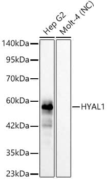 Western Blot: Hyaluronidase 1/HYAL1 Antibody (1N3B1) [NBP3-33459] - Western blot analysis of various lysates, using Hyaluronidase 1/HYAL1 Rabbit mAb at 1:1500 dilution.Secondary antibody: HRP-conjugated Goat anti-Rabbit IgG (H+L) at 1:10000 dilution.Lysates/proteins: 25ug per lane.Blocking buffer: 3% nonfat dry milk in TBST.Detection: ECL Basic Kit.Negative control (NC): MOLT-4Exposure time: 60s.