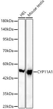 Western Blot: CYP11A1 Antibody (6G3S1) [NBP3-33464] - Western blot analysis of various lysates, using CYP11A1 Rabbit mAb at 1:1000 dilution.Secondary antibody: HRP-conjugated Goat anti-Rabbit IgG (H+L) at 1:10000 dilution.Lysates/proteins: 25ug per lane.Blocking buffer: 3% nonfat dry milk in TBST.Detection: ECL Basic Kit.Exposure time: 180s.