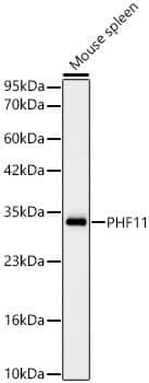 Western Blot PHF11 Antibody (1J3E4)