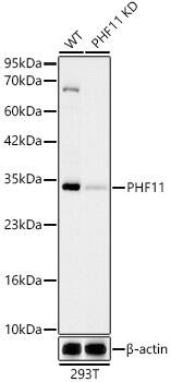 <b>Genetic Strategies Validation. </b>Western Blot: PHF11 Antibody (1J3E4) [PHF11] - Western blot analysis of lysates from wild type(WT) and PHF11 knockdown (KD) 293T cells, using [KD Validated] PHF11 Rabbit mAb  at 1:2000 dilution.Secondary antibody: HRP-conjugated Goat anti-Rabbit IgG (H+L)  at 1:10000 dilution.Lysates/proteins: 25ug per lane.Blocking buffer: 3% nonfat dry milk in TBST.Detection: ECL Basic Kit .Exposure time: 30s.