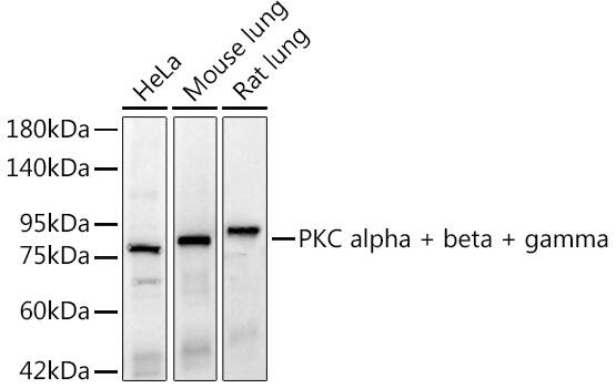Western Blot: PKC Alpha, Beta, Gamma Antibody (9O5J1) [NBP3-33469] - Western blot analysis of various lysates, using PKC Alpha, Beta, Gamma Rabbit mAb at 1:2000 dilution.Secondary antibody: HRP-conjugated Goat anti-Rabbit IgG (H+L) at 1:10000 dilutionLysates/proteins: 25ug per lane.Blocking buffer: 3% nonfat dry milk in TBST.Detection: ECL Basic Kit.Exposure time: 20s.