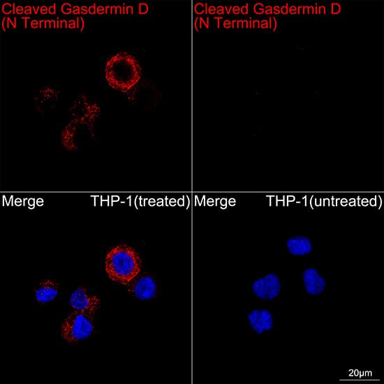 Immunocytochemistry/ Immunofluorescence: GSDMDC1 Antibody (3G1A6) - Cleaved, N-terminal [NBP3-33474] - Confocal imaging of THP-1 cells (treated with PMA and LPS) and THP-1 cells (untreated) cells using [KO Validated] GSDMDC1 Rabbit mAb followed by a further incubation with Cy3 Goat Anti-Rabbit IgG (H+L) (Red). DAPI was used for nuclear staining (Blue). Objective: 100x.