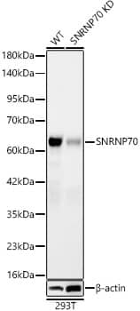 Western Blot: SNRP70 Antibody (2W1C8) [NBP3-33475] - Western Blot analysis of lysates from wild type (WT) and SNRP70 knockdown (KD) 293T cells using  [KD Validated] SNRP70 Rabbit mAb at 1:3000 dilution. Secondary antibody: HRP-conjugated Goat anti-Rabbit IgG (H+L) at 1:10000 dilution. Lysates/proteins: 25 ug per lane.Blocking buffer: 3% nonfat dry milk in TBST.Detection:ECL Basic KitExposure time: 90s.