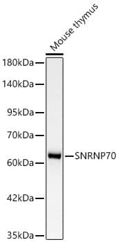 <b>Genetic Strategies Validation. </b>Western Blot: SNRP70 Antibody (2W1C8) [NBP3-33475] - Western Blot analysis of lysates from Mouse thymus using [KD Validated] SNRP70 Rabbit mAb at 1:1000 dilution.Secondary antibody: HRP-conjugated Goat anti-Rabbit IgG (H+L) at 1:10000 dilution.Lysates/proteins: 25 ug per lane.Blocking buffer: 3% nonfat dry milk in TBST.Detection: ECL Basic Kit.Exposure time: 90s.