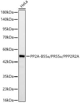 Western Blot PPP2R2A Antibody (9E5N2)