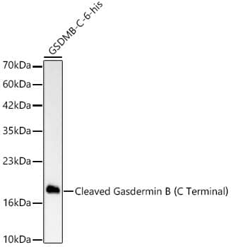 Western Blot: Gasdermin like Antibody (6F4K3) - Cleaved, C-terminal Fragment [NBP3-33477] - Western blot analysis of lysates from GSDMB-C-6-his protein, using Gasdermin like Rabbit mAb at 1:1000 dilution.Secondary antibody: HRP-conjugated Goat anti-Rabbit IgG (H+L) at 1:10000 dilution.Lysates/proteins: 25ug per lane.Blocking buffer: 3% nonfat dry milk in TBST.Detection: ECL Basic Kit.Exposure time: 0.3s.WB samples for antibody validation are kindly provided by Dr. Feng Shao, NIBS