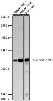 Western Blot: Adenine Nucleotide Translocase 1 Antibody (1U7X1) [NBP3-33484] - Western Blot analysis of various lysates using [KO Validated] Adenine Nucleotide Translocase 1 Rabbit mAb at 1:1000 dilution. Secondary antibody: HRP-conjugated Goat anti-Rabbit IgG (H+L) at 1:10000 dilution. Lysates / proteins: 25 ug per lane. Blocking buffer: 3 % nonfat dry milk in TBST. Detection: ECL Basic Kit. Exposure time: 10s.