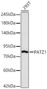 Western Blot: PATZ Antibody (6H7A4) [NBP3-33488] - Western Blot analysis of lysates from 293T cells using PATZ Rabbit mAb at 1:1000 dilution incubated overnight at 4C.Secondary antibody: HRP-conjugated Goat anti-Rabbit IgG (H+L) at 1:10000 dilution.Lysates/proteins: 25 ug per lane.Blocking buffer: 3% nonfat dry milk in TBST.Detection: ECL Basic Kit.Exposure time: 90s.