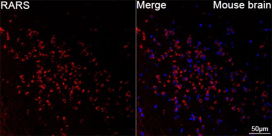 Immunocytochemistry/ Immunofluorescence: Arginyl tRNA synthetase Antibody (4Y1H4) [NBP3-33518] - Confocal imaging of paraffin-embedded Mouse brain tissue using Arginyl tRNA synthetase Rabbit mAb followed by a further incubation with Cy3 Goat Anti-Rabbit IgG (H+L) (Red). DAPI was used for nuclear staining (Blue). High pressure antigen retrieval performed with 0.01M Citrate Buffer (pH 6.0) prior to IF staining. Objective: 40x.