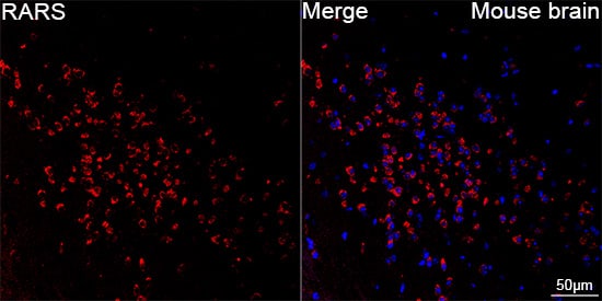 Immunocytochemistry/ Immunofluorescence: Arginyl tRNA synthetase Antibody (4Y1H4) [NBP3-33518] - Confocal imaging of paraffin-embedded Mouse brain tissue using Arginyl tRNA synthetase Rabbit mAb followed by a further incubation with Cy3 Goat Anti-Rabbit IgG (H+L) (Red). DAPI was used for nuclear staining (Blue). Microwave antigen retrieval performed with 0.01M Citrate Buffer(pH 6.0) prior to IF staining. Objective: 40x.