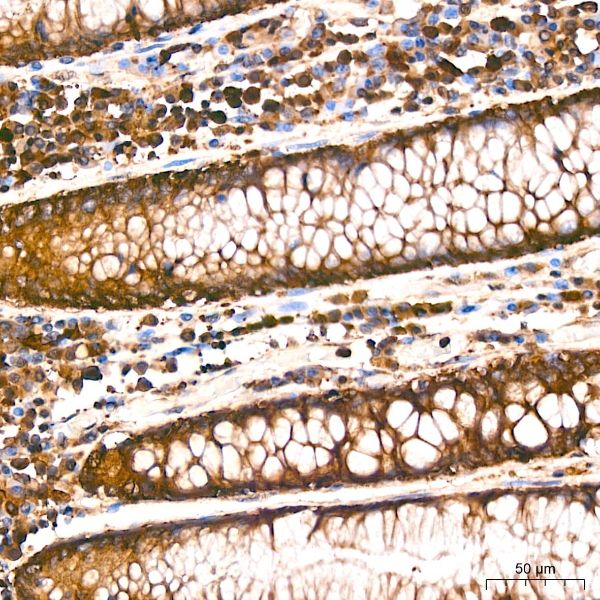 Immunohistochemistry: Arginyl tRNA synthetase Antibody (4Y1H4) [NBP3-33518] - Immunohistochemistry analysis of paraffin-embedded Human colon tissue using Arginyl tRNA synthetase Rabbit mAb at a dilution of 1:200 (40x lens). High pressure antigen retrieval performed with 0.01M Citrate Buffer (pH 6.0) prior to IHC staining.