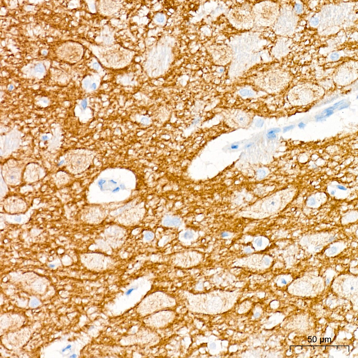 Immunohistochemistry: Trk (pan) Antibody (8A7M10) [NBP3-33525] - Immunohistochemistry analysis of Trk (pan) in paraffin-embedded rat brain tissue using Trk (pan) Rabbit mAb at a dilution of 1:200 (40x lens). High pressure antigen retrieval was performed with 0.01 M citrate buffer (pH 6.0) prior to IHC staining.
