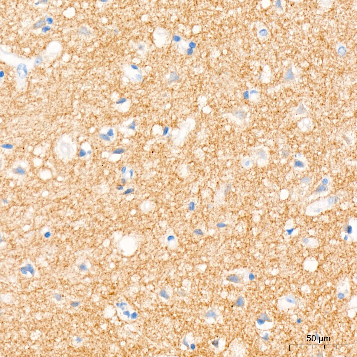 Immunohistochemistry: Trk (pan) Antibody (8A7M10) [NBP3-33525] - Immunohistochemistry analysis of Trk (pan) in paraffin-embedded human brain tissue using Trk (pan) Rabbit mAb at a dilution of 1:200 (40x lens). High pressure antigen retrieval was performed with 0.01 M citrate buffer (pH 6.0) prior to IHC staining.
