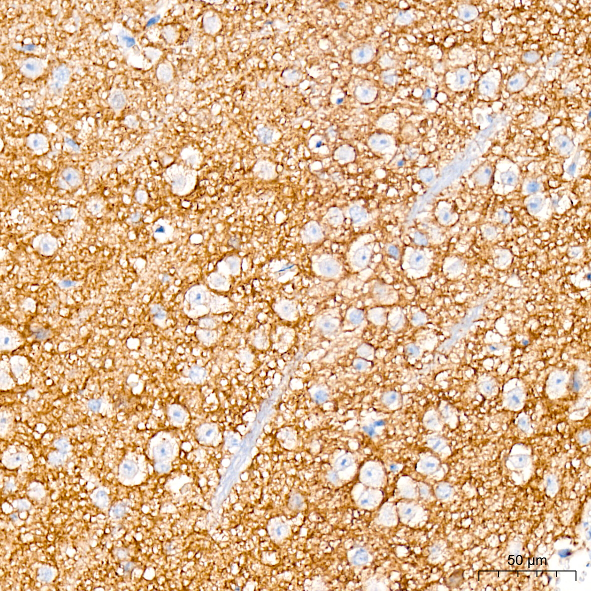 Immunohistochemistry: Trk (pan) Antibody (8A7M10) [NBP3-33525] - Immunohistochemistry analysis of Trk (pan) in paraffin-embedded mouse brain tissue using Trk (pan) Rabbit mAb at a dilution of 1:200 (40x lens). High pressure antigen retrieval was performed with 0.01 M citrate buffer (pH 6.0) prior to IHC staining.
