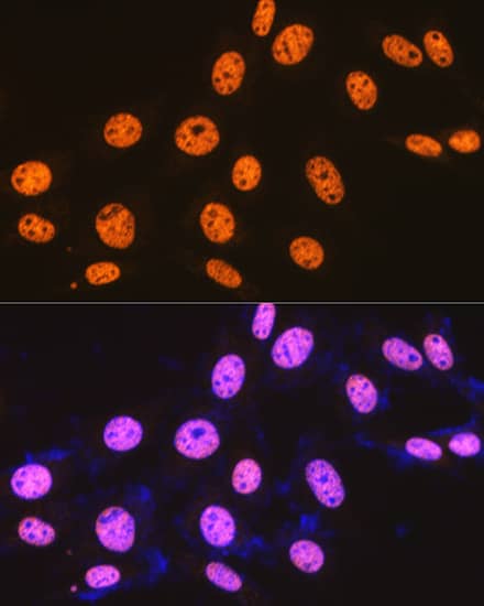 Immunohistochemistry: SFPQ Antibody (8Y5S6) [NBP3-33527] - Immunohistochemistry analysis of paraffin-embedded Rat testis tissue using SFPQ Rabbit mAb  at a dilution of 1:200 (40x lens). High pressure antigen retrieval was performed with 0.01 M citrate buffer (pH 6.0) prior to IHC staining.