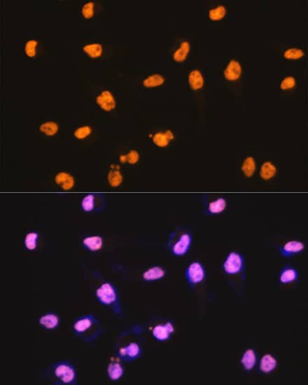 Immunohistochemistry: SFPQ Antibody (8Y5S6) [NBP3-33527] - Immunohistochemistry analysis of paraffin-embedded Mouse brain tissue using SFPQ Rabbit mAb  at a dilution of 1:200 (40x lens). High pressure antigen retrieval was performed with 0.01 M citrate buffer (pH 6.0) prior to IHC staining.