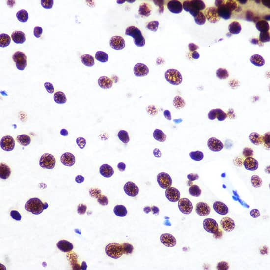 Immunohistochemistry: SFPQ Antibody (8Y5S6) [NBP3-33527] - Immunohistochemistry analysis of paraffin-embedded Human thyroid tissue using SFPQ Rabbit mAb  at a dilution of 1:200 (40x lens). High pressure antigen retrieval was performed with 0.01 M citrate buffer (pH 6.0) prior to IHC staining.