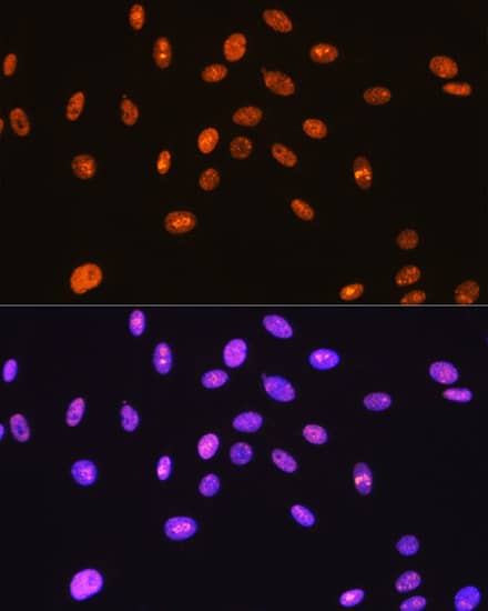 Immunohistochemistry: SFPQ Antibody (8Y5S6) [NBP3-33527] - Immunohistochemistry analysis of paraffin-embedded Rat colon tissue using SFPQ Rabbit mAb  at a dilution of 1:200 (40x lens). High pressure antigen retrieval was performed with 0.01 M citrate buffer (pH 6.0) prior to IHC staining.