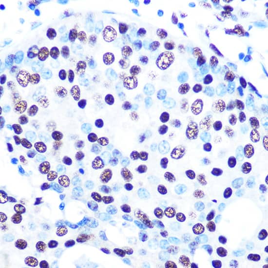 Immunohistochemistry: SFPQ Antibody (8Y5S6) [NBP3-33527] - Immunohistochemistry analysis of paraffin-embedded Human colon tissue using SFPQ Rabbit mAb  at a dilution of 1:200 (40x lens). High pressure antigen retrieval was performed with 0.01 M citrate buffer (pH 6.0) prior to IHC staining.