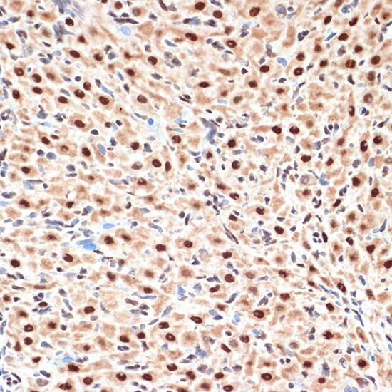 Immunohistochemistry: CDC16 Antibody (7Y1Y10) [NBP3-33529] - Immunohistochemistry analysis of paraffin-embedded Rat ovary using CDC16 Rabbit mAb at dilution of 1:100 (40x lens). Microwave antigen retrieval performed with 0.01M Tris/EDTA Buffer (pH 9.0) prior to IHC staining.