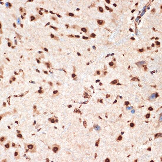 Immunohistochemistry: CDC16 Antibody (7Y1Y10) [NBP3-33529] - Immunohistochemistry analysis of paraffin-embedded Mouse spinal cord using CDC16 Rabbit mAb at dilution of 1:100 (40x lens). Microwave antigen retrieval performed with 0.01M Tris/EDTA Buffer (pH 9.0) prior to IHC staining.