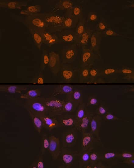 Immunocytochemistry/ Immunofluorescence CDC16 Antibody (7Y1Y10)