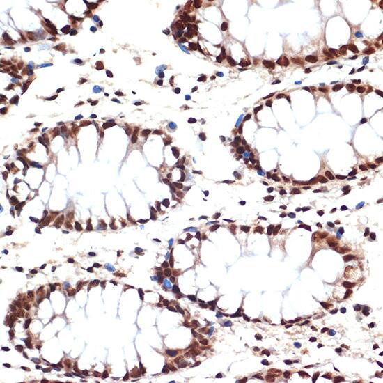 Immunohistochemistry: CDC16 Antibody (7Y1Y10) [NBP3-33529] - Immunohistochemistry analysis of paraffin-embedded Human colon using CDC16 Rabbit mAb at dilution of 1:100 (40x lens). Microwave antigen retrieval performed with 0.01M Tris/EDTA Buffer (pH 9.0) prior to IHC staining.