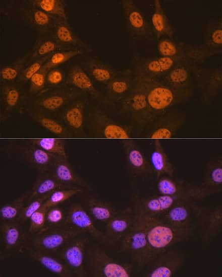 Immunocytochemistry/ Immunofluorescence CDC16 Antibody (7Y1Y10)