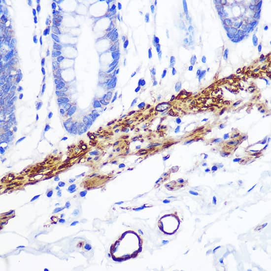 Immunohistochemistry: Desmin Antibody (6O9O4) [NBP3-33531] - Immunohistochemistry analysis of paraffin-embedded Human stomach tissue using Desmin Rabbit mAb  at a dilution of 1:1600 (40x lens). High pressure antigen retrieval was performed with 0.01 M Tris-EDTA buffer (pH 9.0) prior to IHC staining.