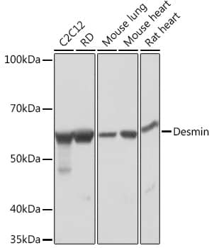 Western Blot: Desmin Antibody (6O9O4) [NBP3-33531] - Western blot analysis of various lysates using Desmin Rabbit mAb at 1:1000 dilution.Secondary antibody: HRP-conjugated Goat anti-Rabbit IgG (H+L) at 1:10000 dilution.Lysates/proteins: 25ug per lane.Blocking buffer: 3% nonfat dry milk in TBST.Detection: ECL Basic Kit.Exposure time: 1s.