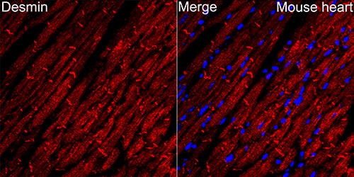 Immunohistochemistry: Desmin Antibody (6O9O4) [NBP3-33531] - Immunohistochemistry analysis of paraffin-embedded Human smooth muscle tissue using Desmin Rabbit mAb  at a dilution of 1:1600 (40x lens). High pressure antigen retrieval was performed with 0.01 M Tris-EDTA buffer (pH 9.0) prior to IHC staining.