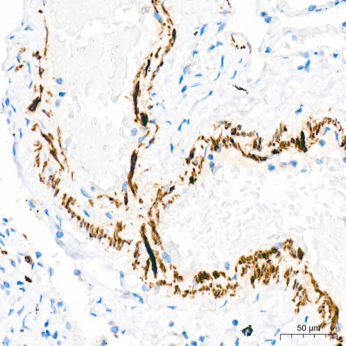 Immunohistochemistry: Desmin Antibody (6O9O4) [NBP3-33531] - Immunohistochemistry analysis of paraffin-embedded Human lung tissue using Desmin Rabbit mAb at a dilution of 1:1600 (40x lens). High pressure antigen retrieval was performed with 0.01 M Tris-EDTA buffer (pH 9.0) prior to IHC staining.