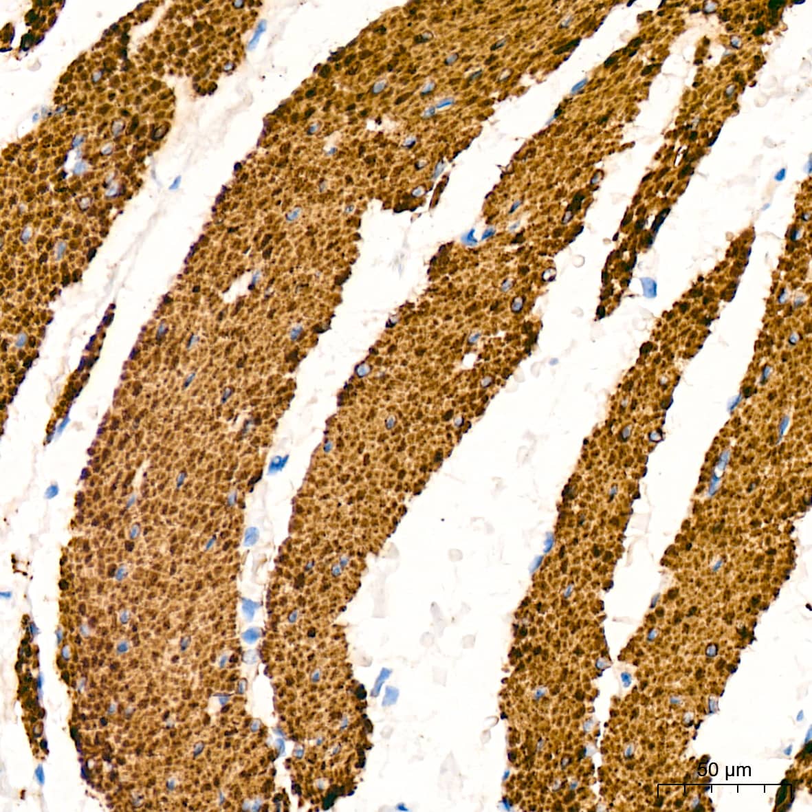 Immunohistochemistry: Desmin Antibody (6O9O4) [NBP3-33531] - Immunohistochemistry analysis of paraffin-embedded Human smooth muscle tissue using Desmin Rabbit mAb at a dilution of 1:1600 (40x lens). High pressure antigen retrieval was performed with 0.01 M Tris-EDTA buffer (pH 9.0) prior to IHC staining.